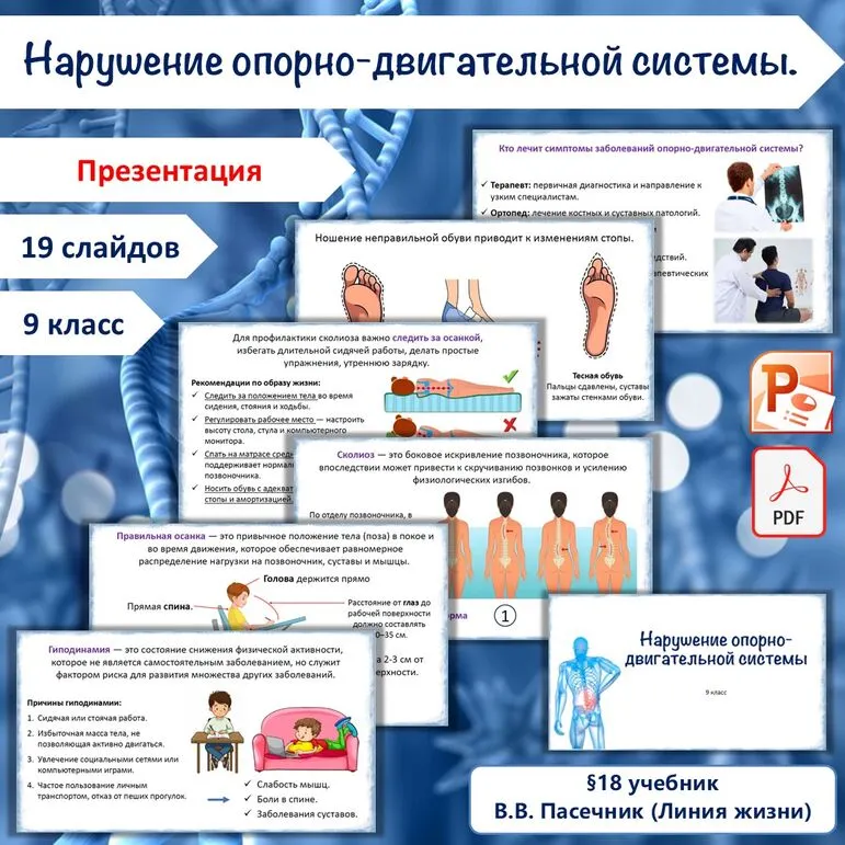 Презентация «Нарушение опорно-двигательной системы», 9 класс