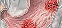 http://www.krasotaimedicina.ru/upload/iblock/3f8/3f8349b9974b7da512a77ba5628e9b70.jpg