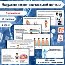 Презентация «Нарушение опорно-двигательной системы», 9 класс